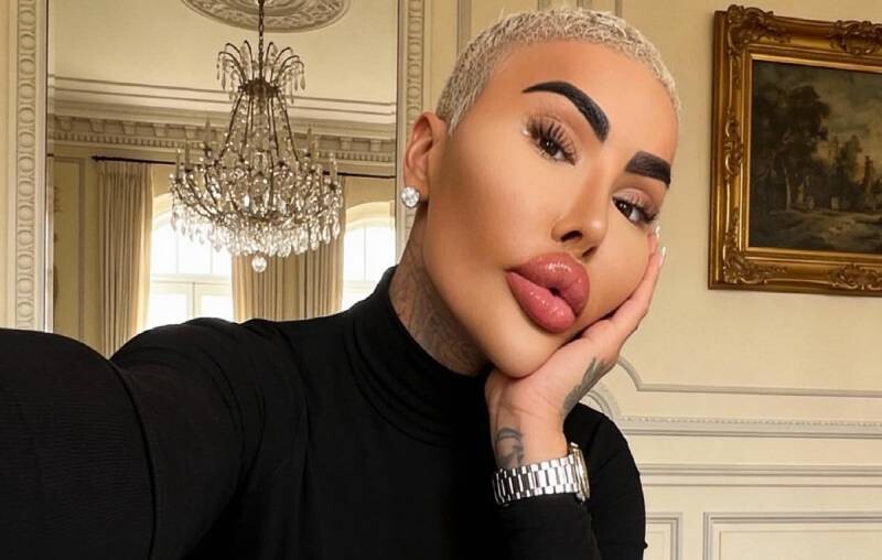 British "King of Lips" influencer dies after surgery