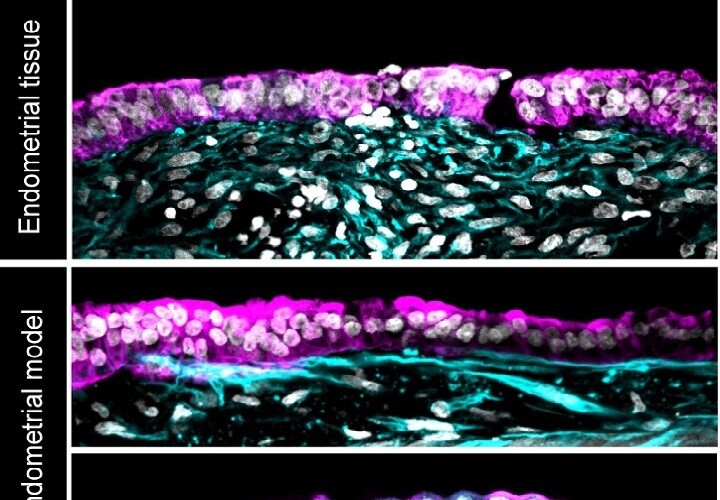 Scientists Develop Artificial Endometrium to Study Early Pregnancy Stages