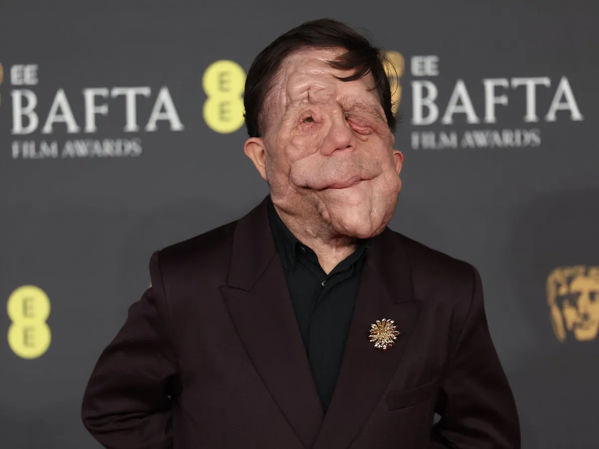 演员亚当·皮尔森回应关于他外貌的玩笑