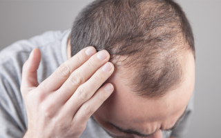 Baldness May Be Attractive to Women, Study Finds