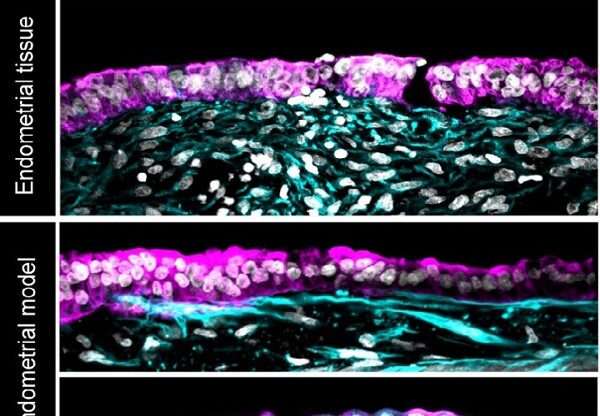 Scientists Develop Artificial Endometrium to Study Early Pregnancy Stages